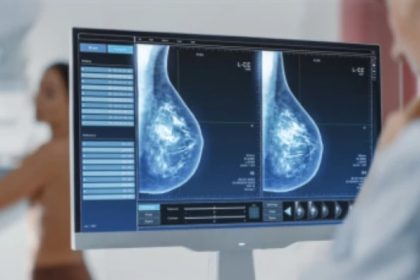 sansa la viata mamografii cu tomosinteza gratuite pentru pacientele oncologice din constanta 6811386d75983