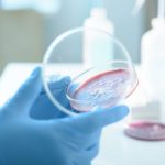 ce este serratia marcescens bacteria descoperita la spitalul sfanta maria din iasi unde au murit sase copii 68d698fdd606b