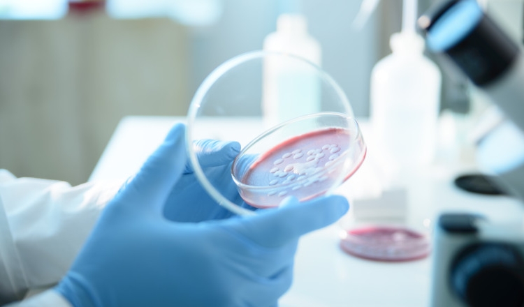 ce este serratia marcescens bacteria descoperita la spitalul sfanta maria din iasi unde au murit sase copii 68d698fdd606b