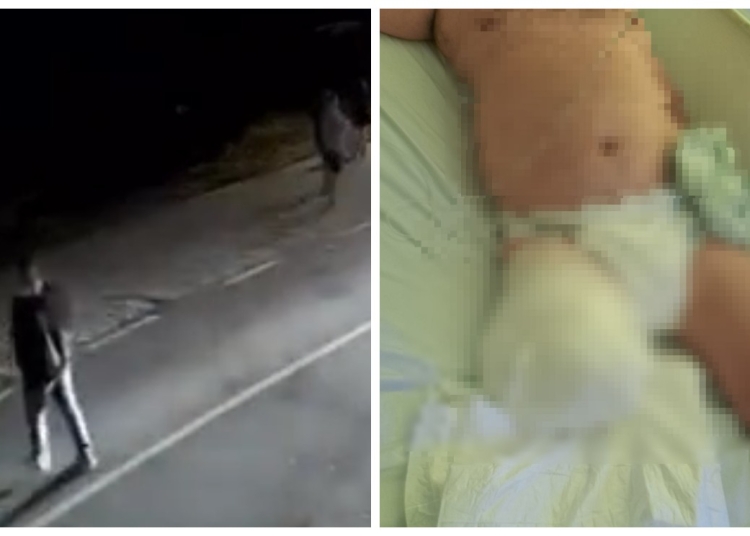 video imagini cu puternic impact emotional din timpul producerii accidentului de la oltina unde un barbat a ramas fara un picior 68c7c848dc63f