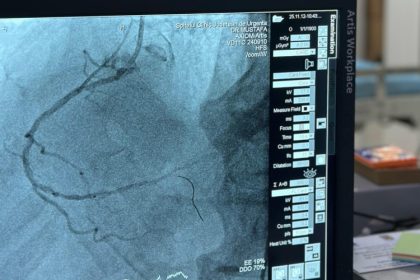 performanta medicala 100 de interventii coronariene realizate la scju constanta 69147986ecb99