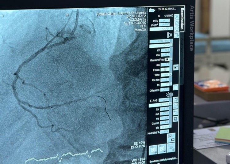 performanta medicala 100 de interventii coronariene realizate la scju constanta 69147986ecb99
