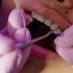 propunerea ministrului sanatatii care ar putea schimba desfasurarea interventiilor chirurgicale stomatologice 69199331d697f