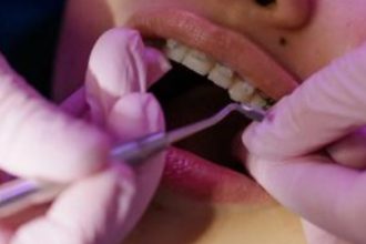 propunerea ministrului sanatatii care ar putea schimba desfasurarea interventiilor chirurgicale stomatologice 69199331d697f