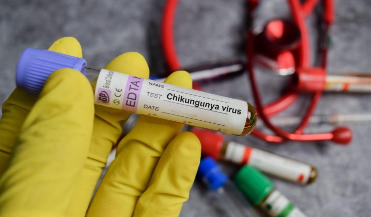alerta in romania primul caz de virus chikungunya confirmat la un barbat venit din africa 697c76a9ec2f5