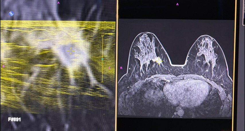 foto premiera nationala la spitalul judetean constanta prima punctie mamara ecoghidata cu fuziune de imagini irm 698ec4665e646