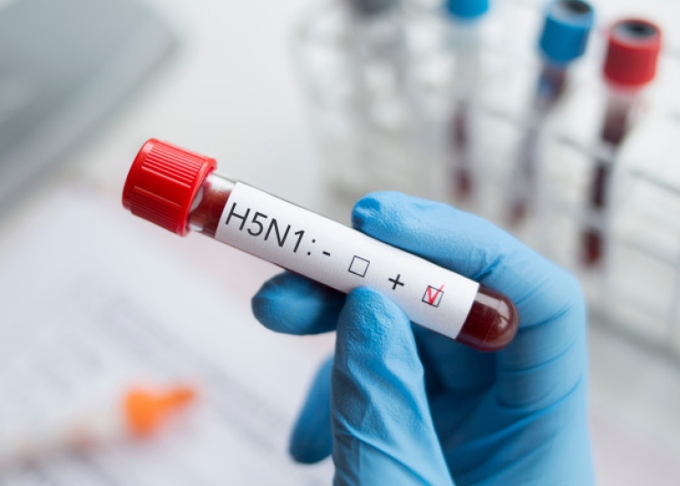 primul caz european de gripa aviara h9n2 la om semnalat in italia 69ce41b858898